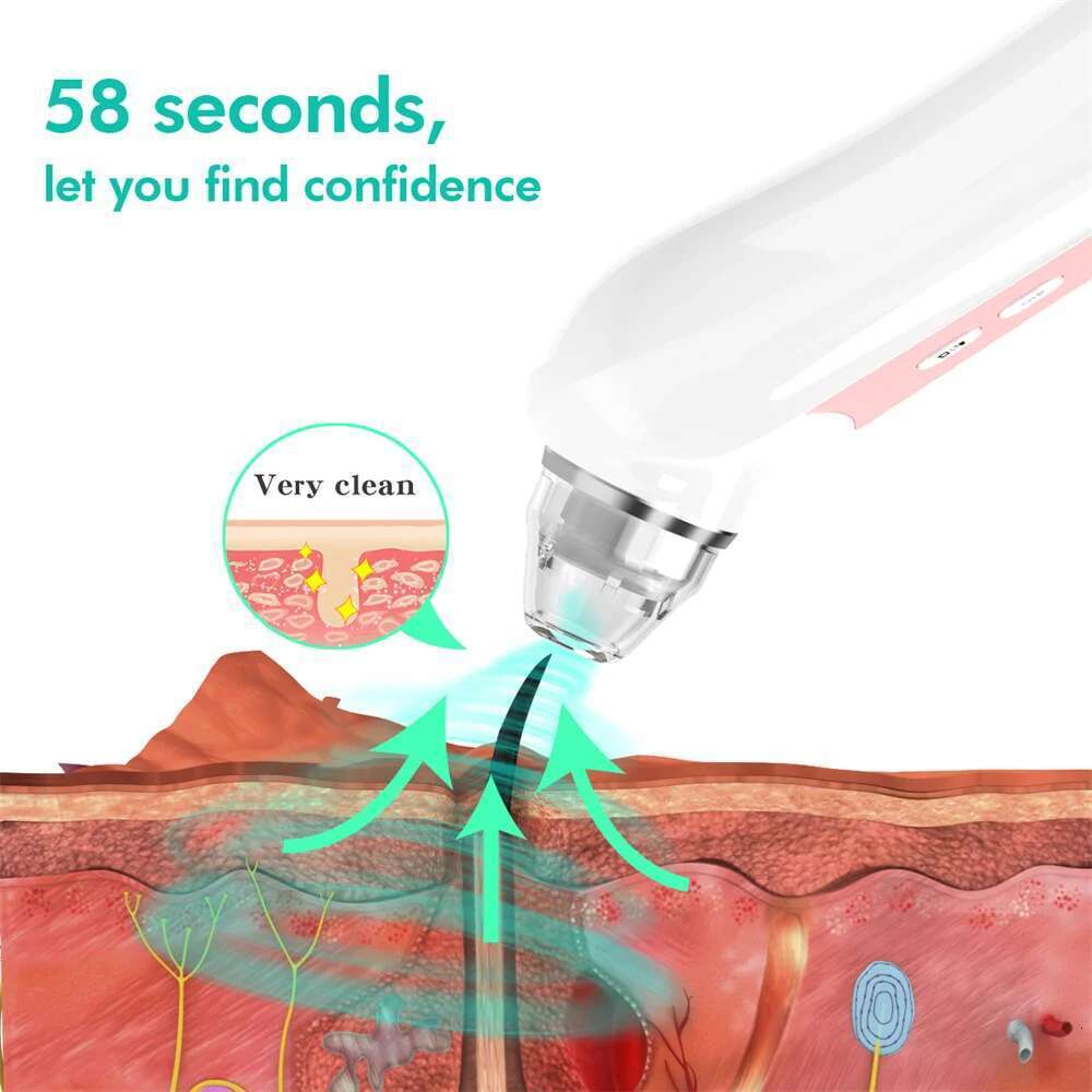 Blackhead Remover With Camera Vacuum Pore Black Head Extractions Tool 3 Adjustment Modes & 6 Suction Heads For Men And Women