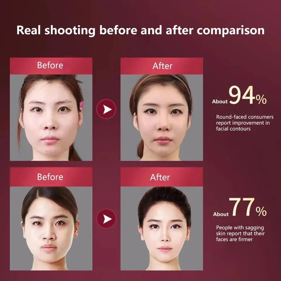 Facial Massager 12 Gears Electric Facial Massager V-line Face Slimming Vibration Device Home Use Beauty Tool 251112