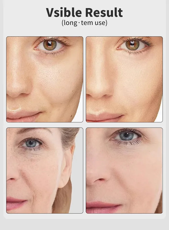 7 Colors EMS Microcurrent Facial Massager Age-R Booster Pro Lift Device Home Use Beauty Tool for Skin Care Rejuve 251112