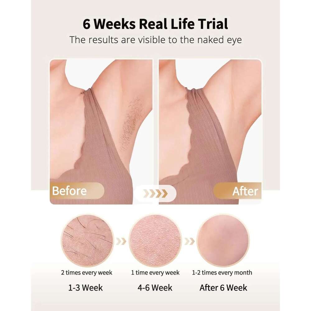 Laser Removal With Ice Coog Care Function For Women Men Permanent,Unlimited Flashes Painless Epilator IPL Hair Remover