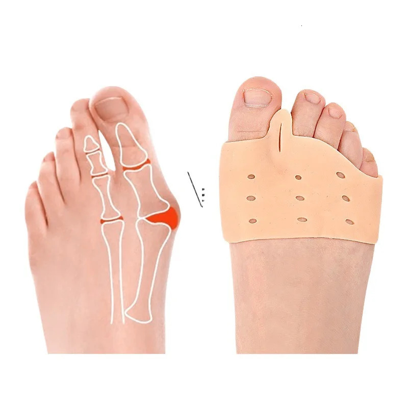 Forefoot Pad Left And Right Foot Clamping SEBS Hallux Valgus Protection Cover Insole Big Toe Divider 251121