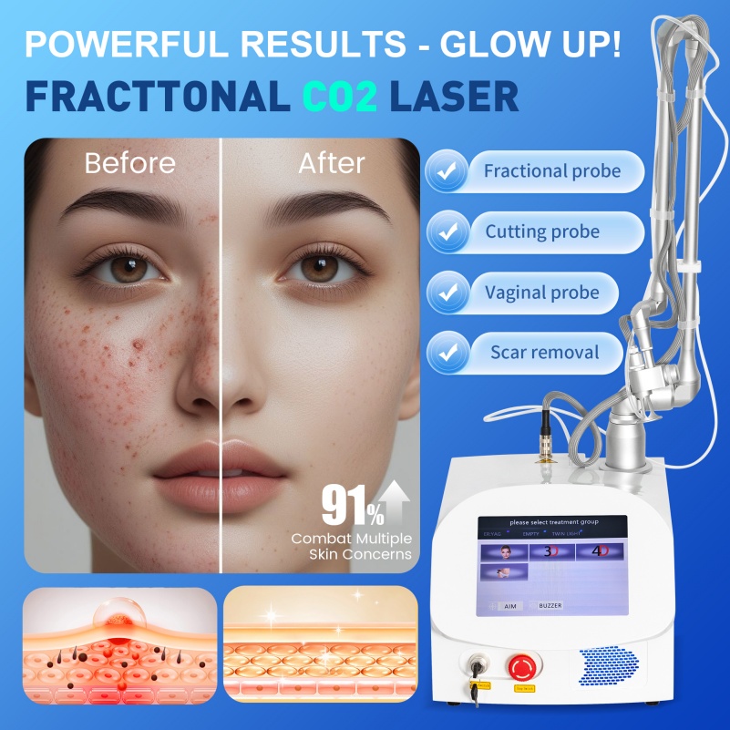 CO2 Laser Fractional Co2 Laser Professional Machine Wrinkle Scar Removal Carbon Peeling Stretch Mark Removal