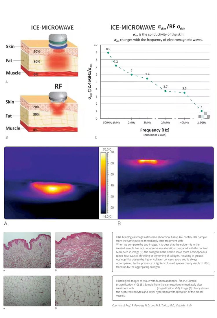 Coolwaves Body Slimming Machine Skin Tightening & Lifting with Microwave Energy Collagen Regeneration Device
