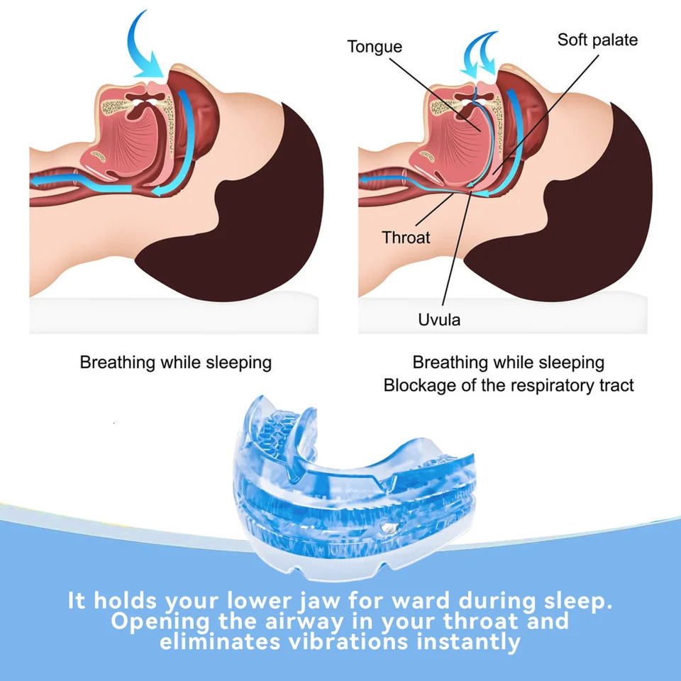Anti Snore Bruxism Mouth Guard Stop Snoring Mouthpiece Teeth Bruxism Sleeping Aid Apnea Devices Night Anti-Snoring Mouth Guard 250421