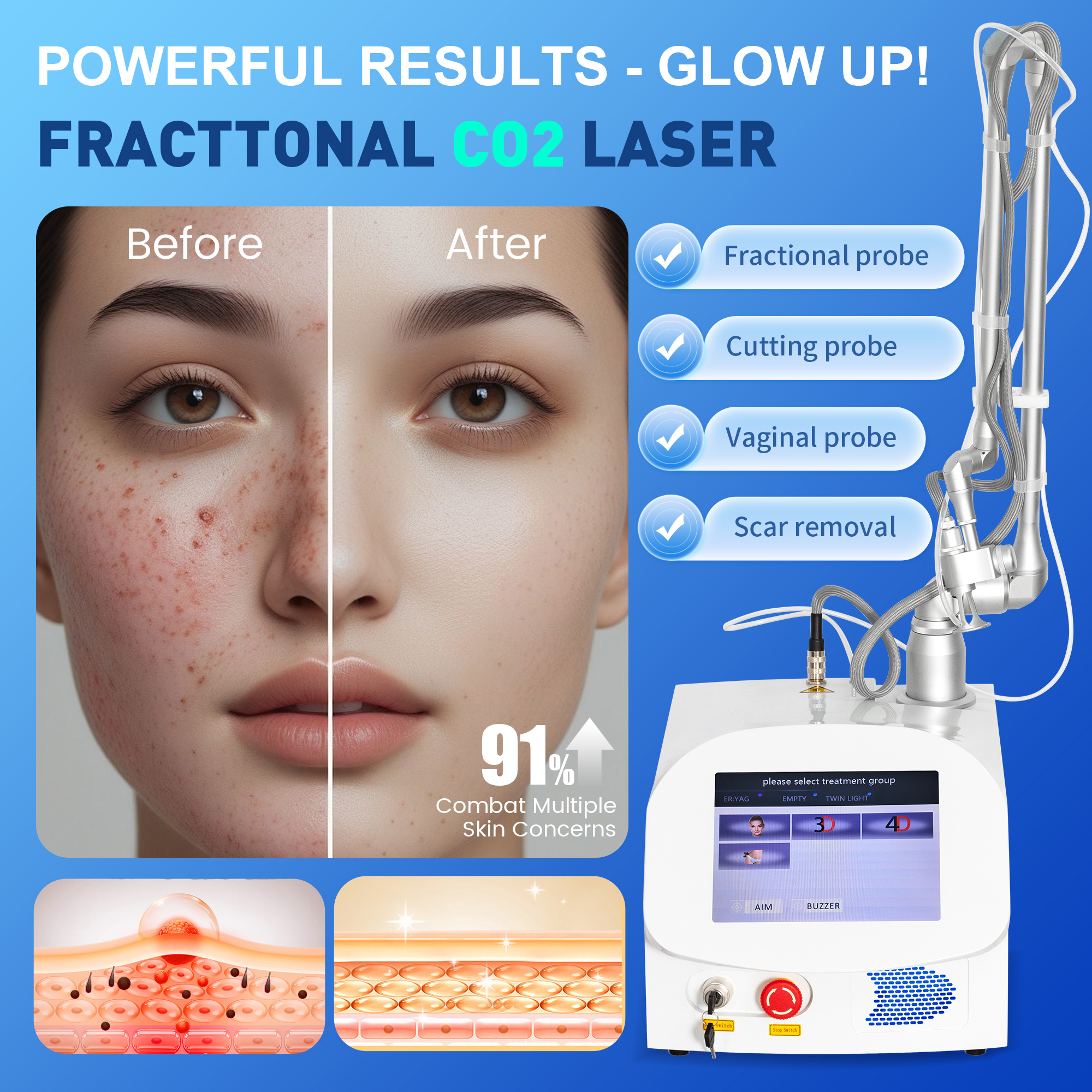 CO2 Laser Fractional Co2 Laser Professional Device Wrinkle Scar Removal Carbon Peeling Stretch Mark Removal