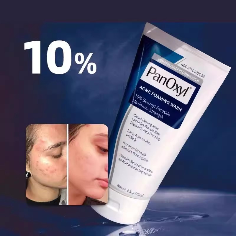 10% Benzoyl Peroxide Anti-Acne Face Wash - Moisturizing Deep Cleansing, Protecting Skin, Unclogging Pores, Oil Control on Face