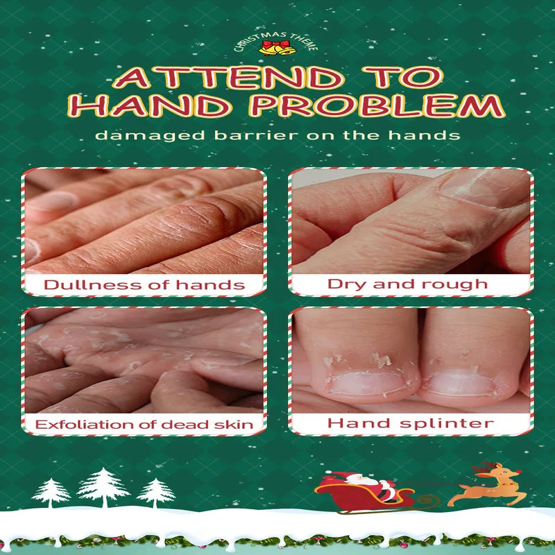 5Pack Hand Cream Protect For Dry Cracked Hands Moisturizing Lotion Suitable Dehydrated d Skincare 251103