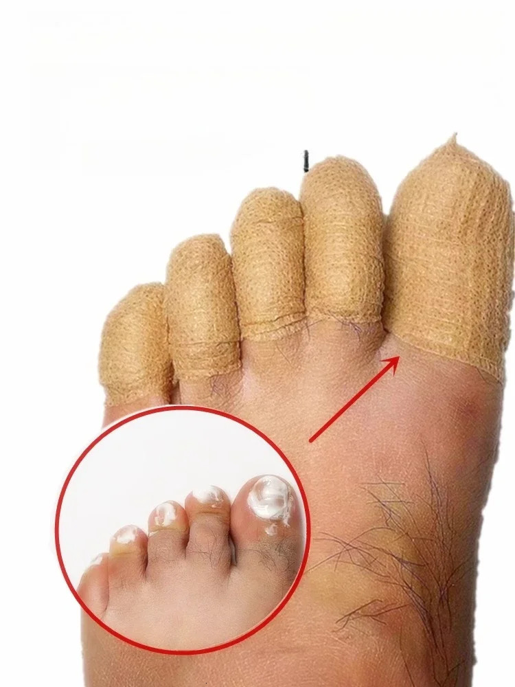 Toe protection selfadhesive bandage fungal nail polish foot and finger coating toe 251106