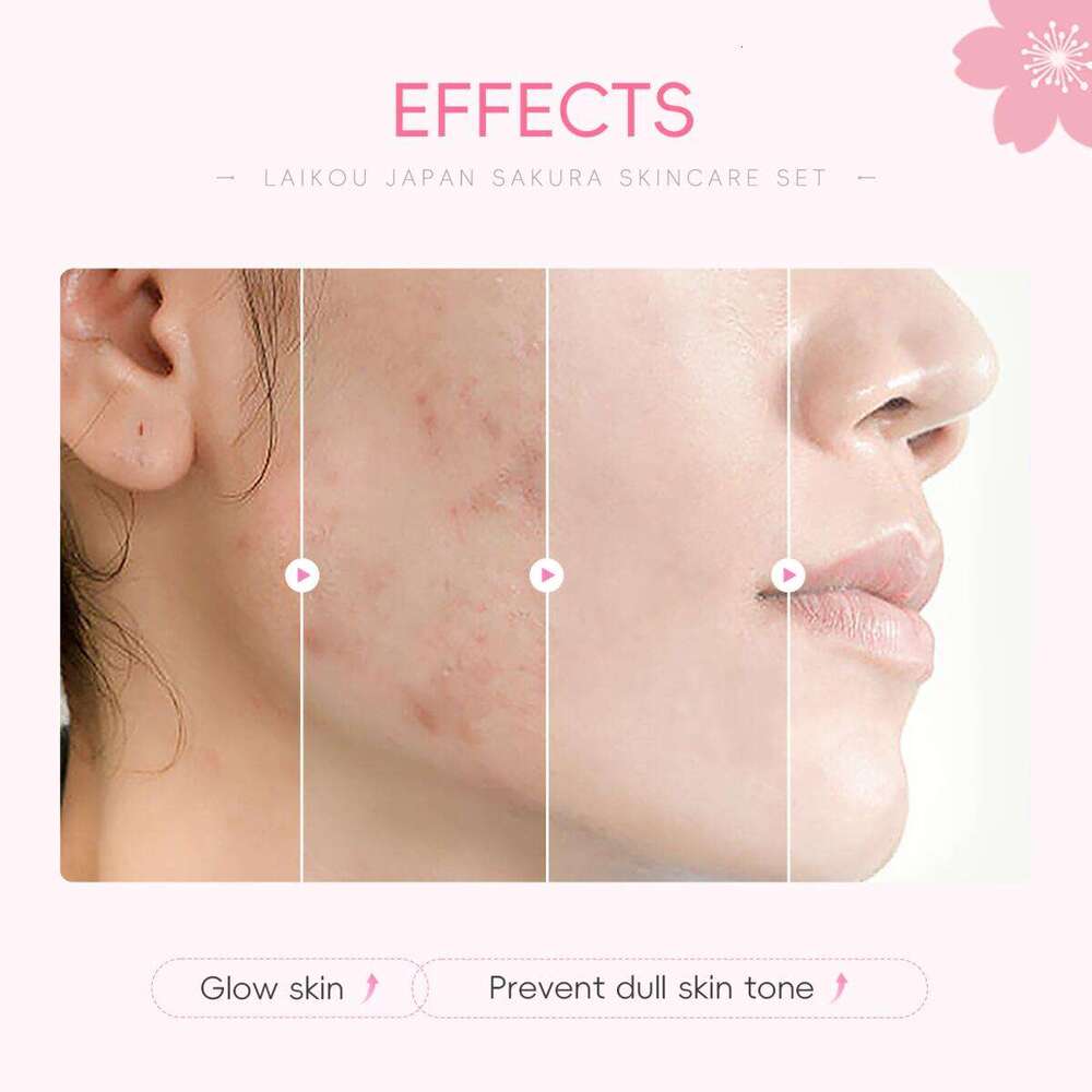 Sets Kits Laikou 8Pcs Skincare Set Sakura Cleanser Toner Lotion Cream Deep Cleansing Moisturizing Oil Control Portable Kit Travel X251124