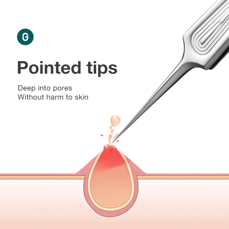 MR.GREEN Ingrown Hair Tweezers Needle Nose Pointed Tips Eyebrows Tweezers For Splinters Blackhead Removal Acne Clip ctor 250422