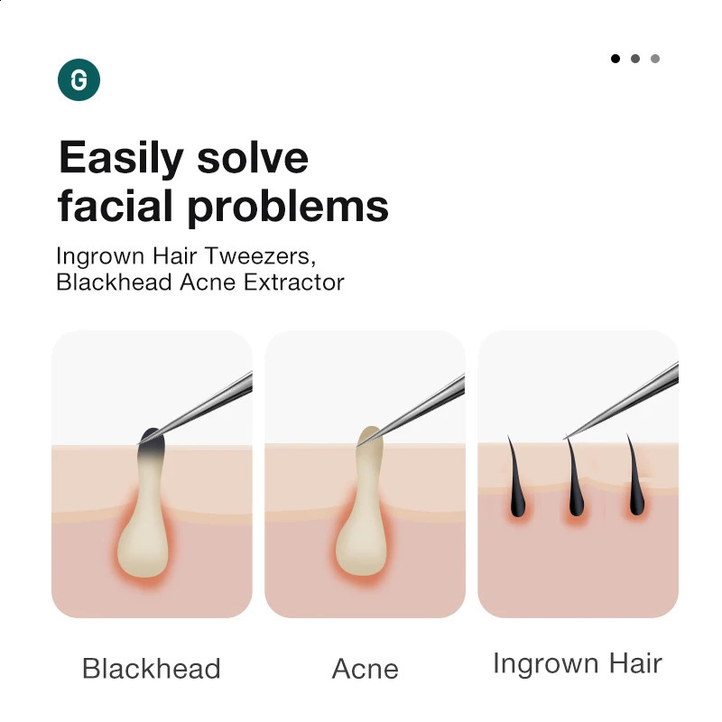 MR.GREEN Ingrown Hair Tweezers Needle Nose Pointed Tips Eyebrows Tweezers For Splinters Blackhead Removal Acne Clip ctor 250422