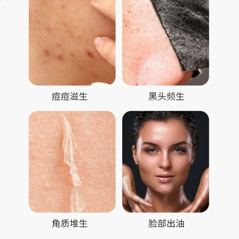 Household Ultrasonic Beauty Charging Skin Rejuvenation Face Firming Export Cleaning Pore Scraping Blackhead Acne 250121