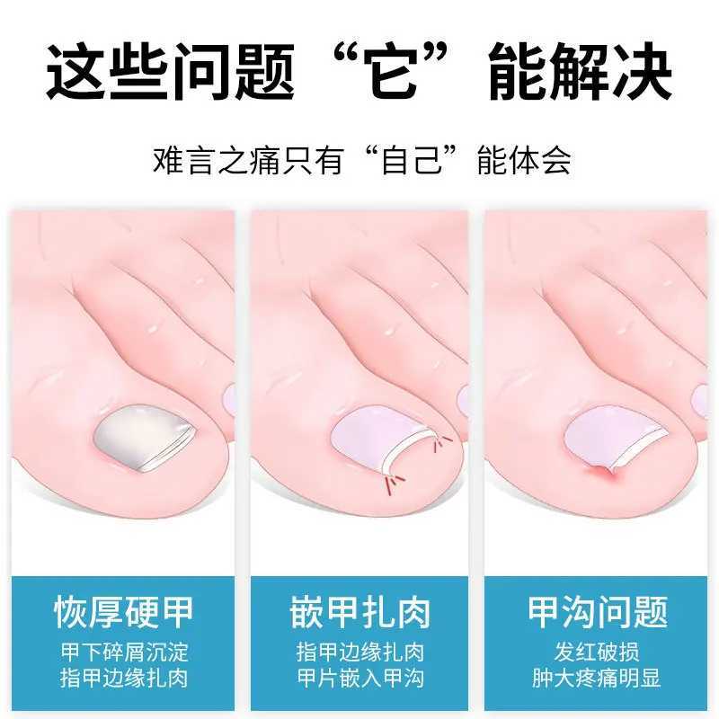 Toe Nail Clippers Correction Thick Nail Ingrown Toenails Nippers Dead Skin Nail Art Pedicure Care Plier Cutter Scissor ToolXJ250121