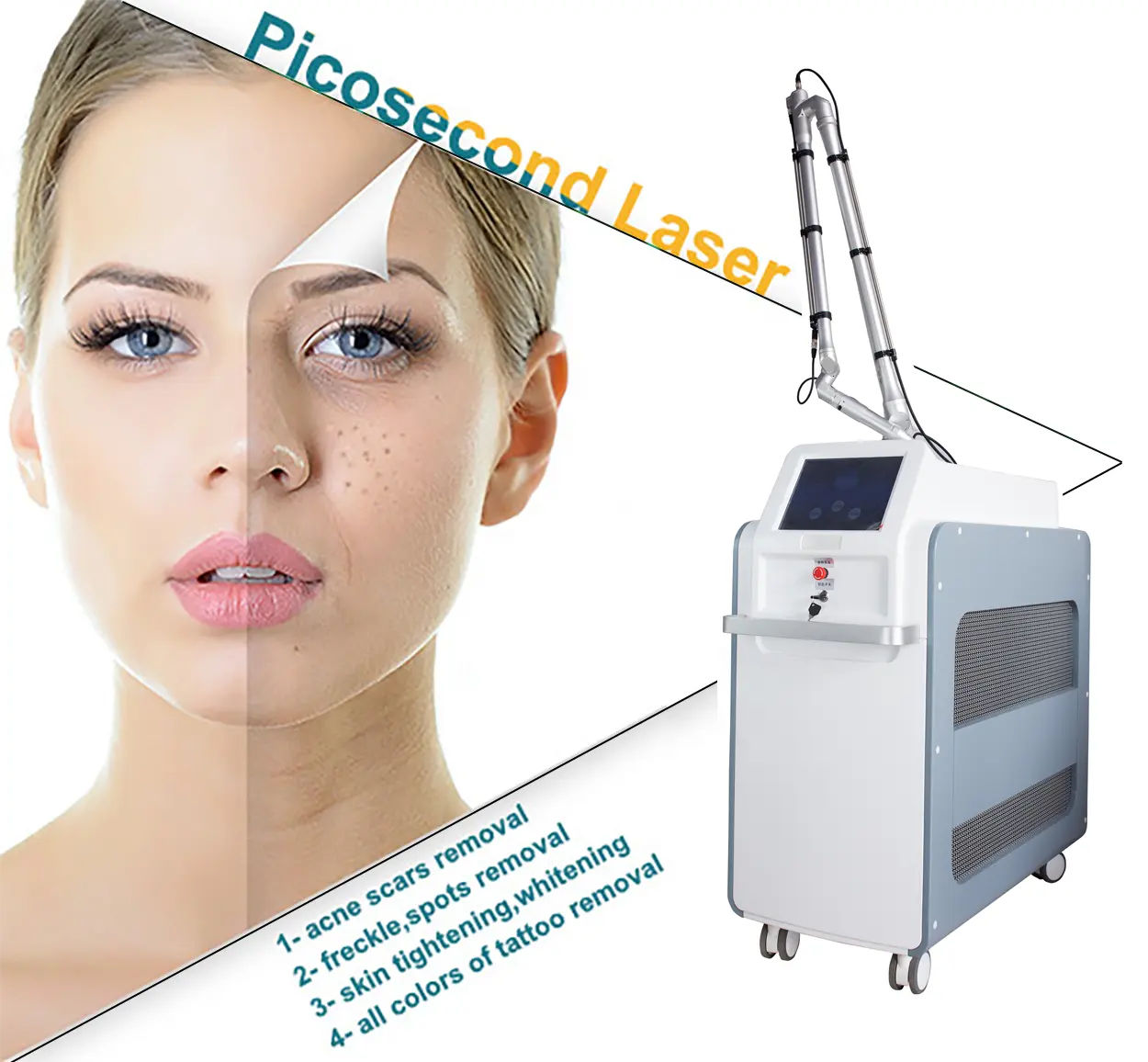 Q Switched Nd Yag Laser Tattoo Removal Machine Laser Picosecond Diode Laser Freckle Removal Machine