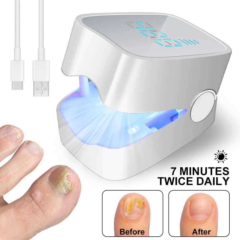 Traitement des champignons à ongles UV LED LAMPE LASER ÉQUIPEMENT POUR LETTRAPHIE DE THYRODITE USB LAMPE UV UV POUR DES NOI