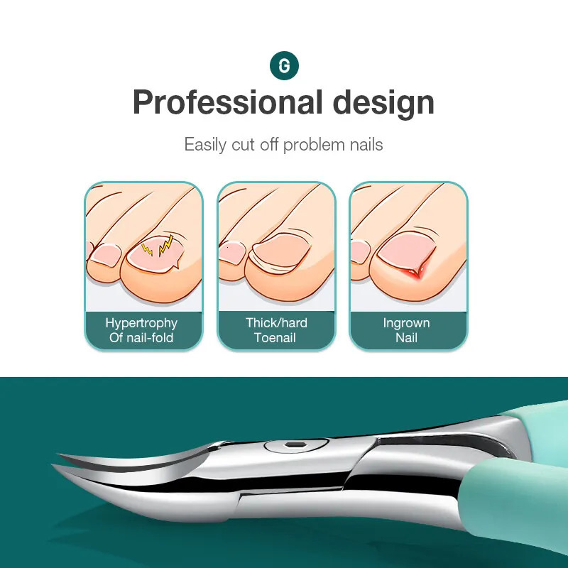 MR.GREEN Toenail Clippers Anti-Splash Ingrown Nail Olecranon Cutters Professional Pedicure Tools Stainless Steel 250113