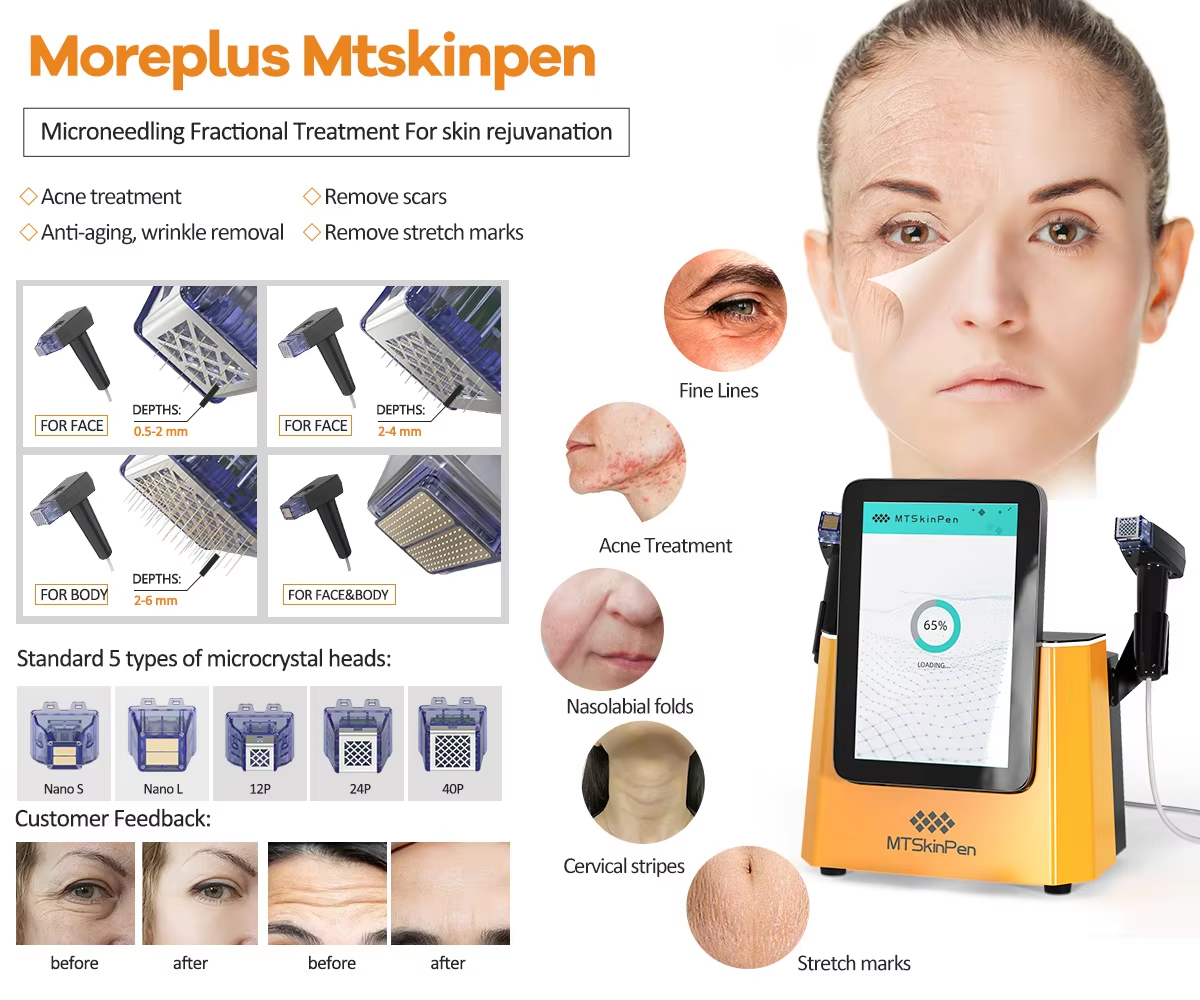 Fractional RF anti-aging wrinkle removal skin rejuvenation face lifting Rf radio frequency skin lifting acne scar treatment gold Rf micro needling ant