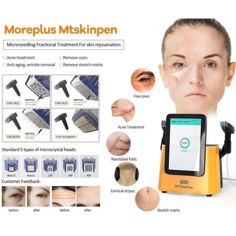 2 In 1 rf fractional radio frequency anti-aging wrinkle removal skin rejuvenation face lifting micro needle skin tightening stretch scars marks remova