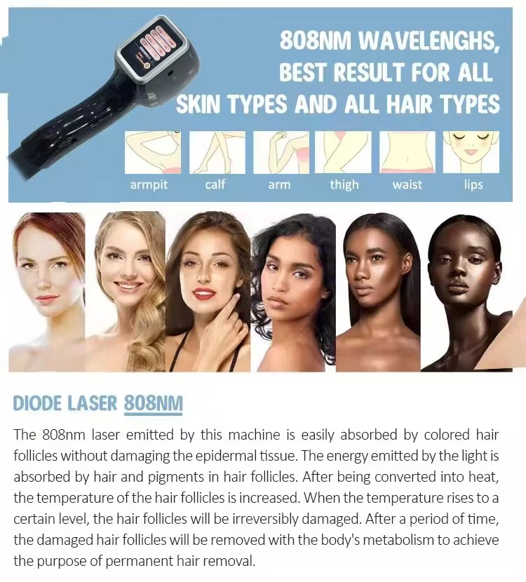 Diode Laser 808 Hair Removal Machine Picosecond Nd Yag Tattoo Removal Skin Whitening Device