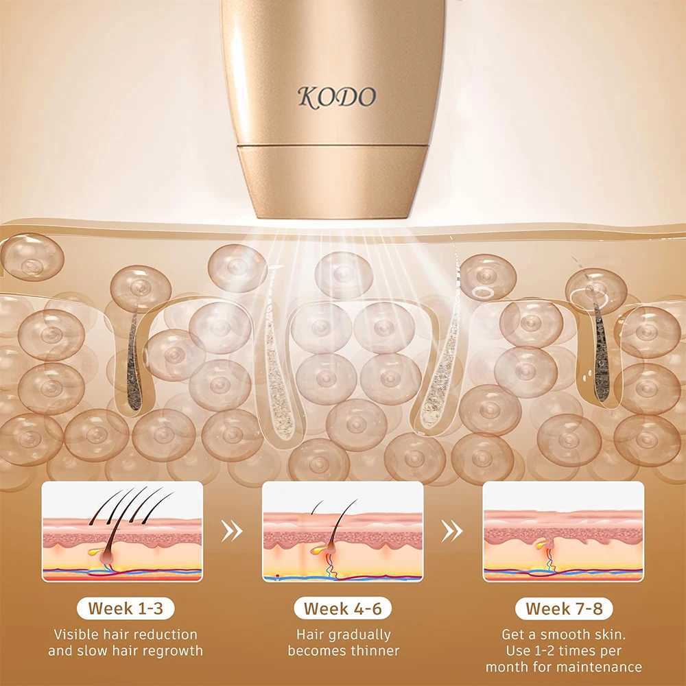 KODO 2024 High-end customization ice Laser Hair removal Laser Epilator Permanent IPL Painless Photoepilator 4 in 1 face and body Z250218