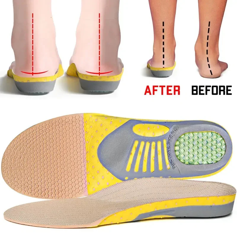 1 Pair Orthopedic Insoles Ortics Flat Foot Health Sole Pad Arch Support for Plantar Fasciitis Feet Care 250219
