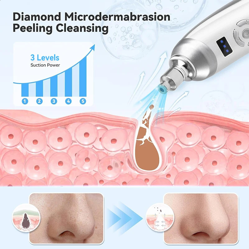 Upgraded Diamond Microdermabrasion Machine Blackhead Removal Professional Facial Deep Cleasing Device Home Use Facial Skin Care 250218