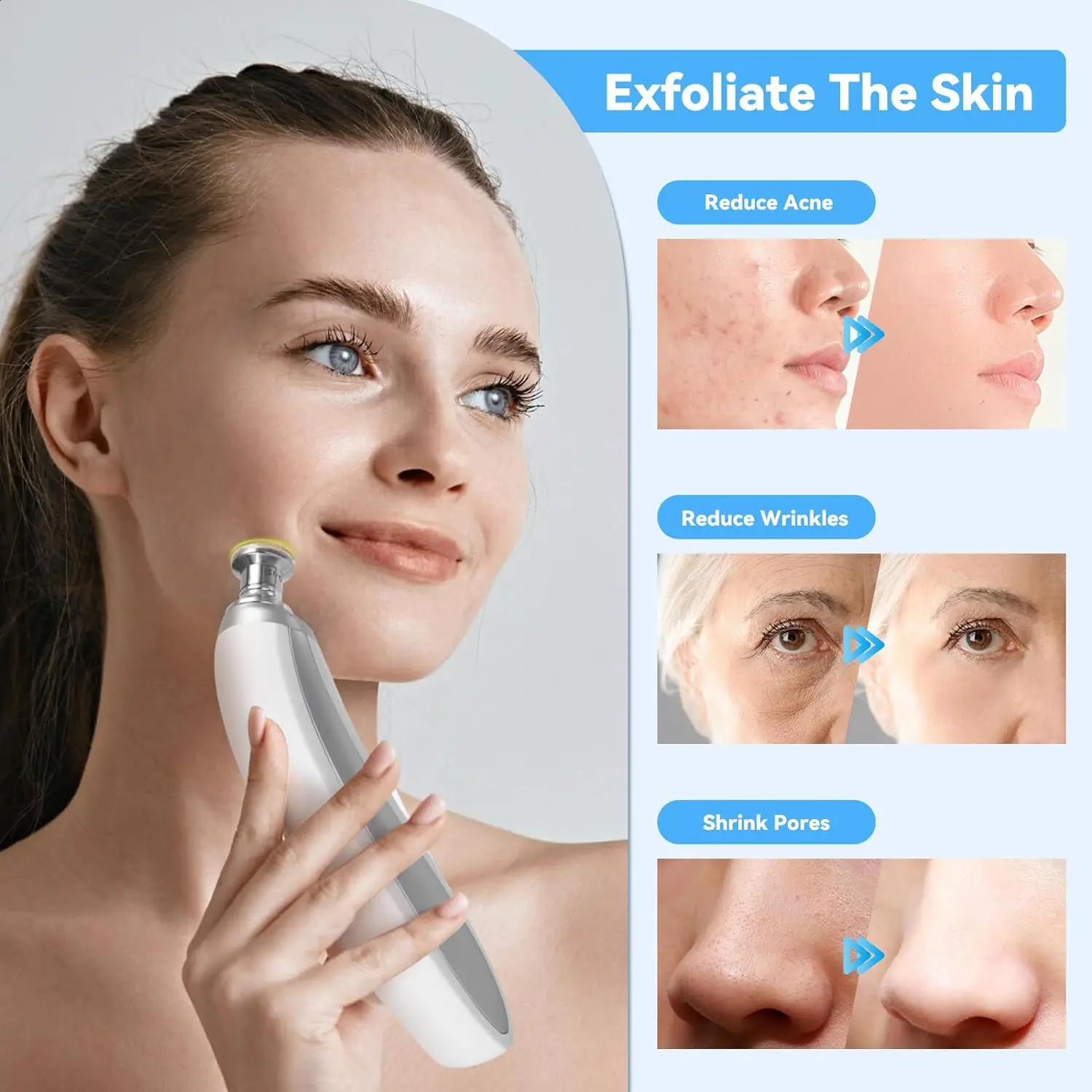 Upgraded Diamond Microdermabrasion Machine Blackhead Removal Professional Facial Deep Cleasing Device Home Use Facial Skin Care 250218