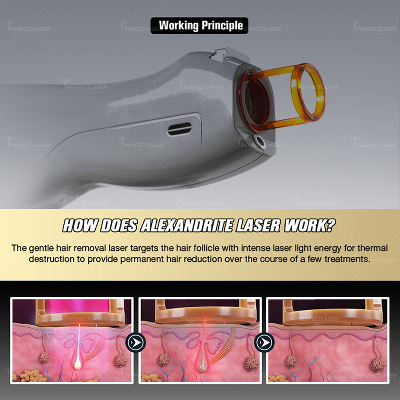 1064nm Alexandrite Laser Hair Removal Machine Lazer Hair Remover for Ladies Skin Rejuvenation Nd Yag TEC Cooling Long Pulse Device