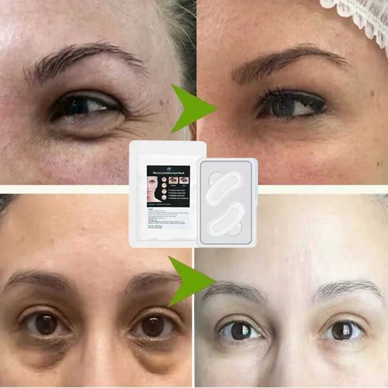 Hyaluronic Eye Mask Anti-Wrinkle Eye Patches Hydrating Moisturizing Smooth Crows feet Eye Care Dark CirclesXJ250224