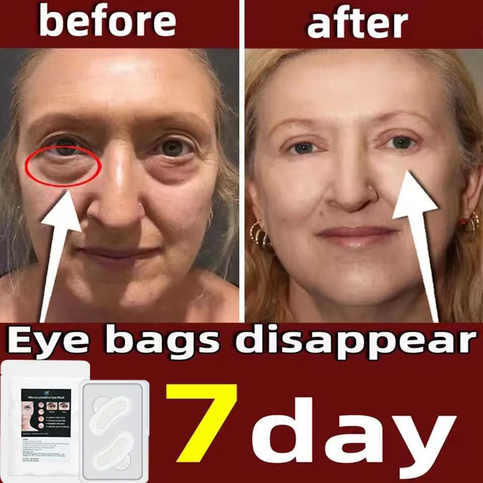 Hyaluronic Eye Mask Anti-Wrinkle Eye Patches Hydrating Moisturizing Smooth Crows feet Eye Care Dark CirclesXJ250224