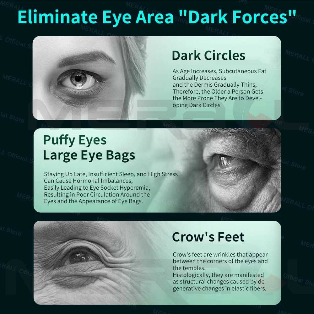 3D Eye Massager Micro Flow Pulse Relaxation Fatigue Relief Light Dark Circulation Smooth Eye Fine Line Beauty Skin Eye CareXJ250224