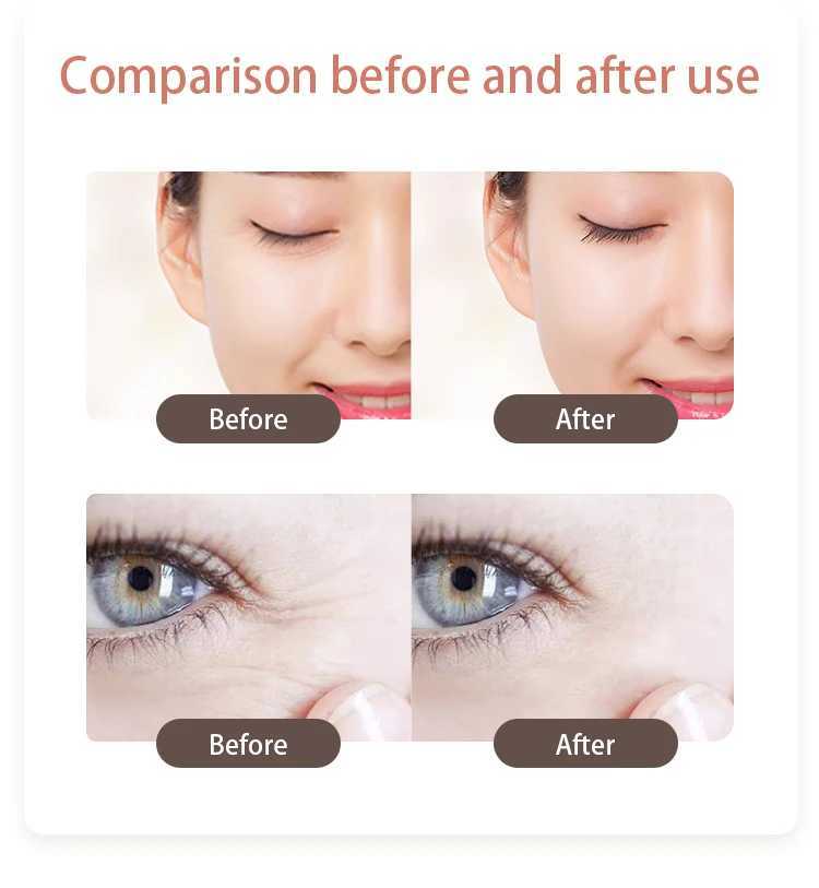 Mini Electric Eye Beauty Instrument Anti-aging Wrinkle Eye Massage Pen Portable Dark Circle Vibration Disapear Device Thin FaceXJ250224