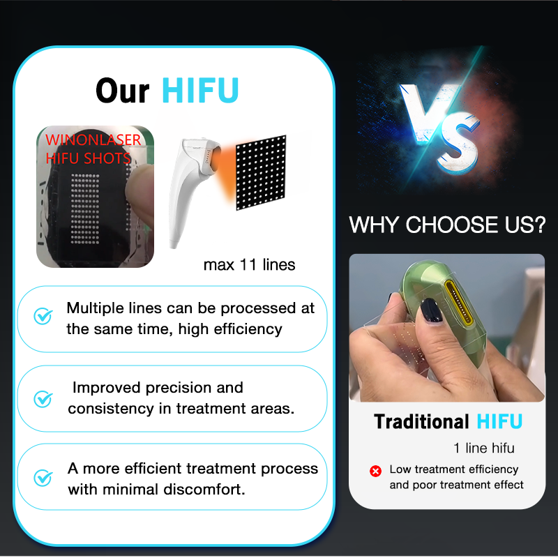 2025 Portable HIFU Smas Face Lifting Machine 13 Cartridges Vmax Wrinkle Remover Device for Anti-aging Body Shaping