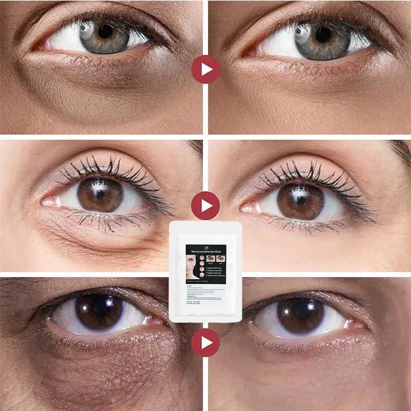 Hyaluronic Eye Mask Anti-Wrinkle Eye Patches Hydrating Moisturizing Smooth Crows feet Eye Care Dark CirclesXJ250224