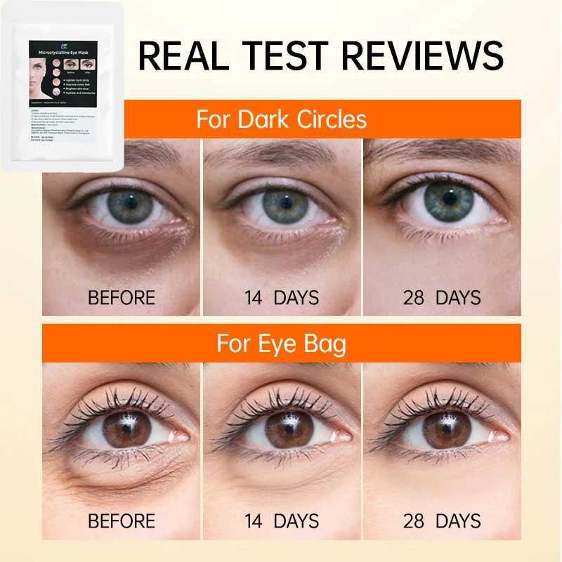 Hyaluronic Eye Mask Anti-Wrinkle Eye Patches Hydrating Moisturizing Smooth Crows feet Eye Care Dark CirclesXJ250224