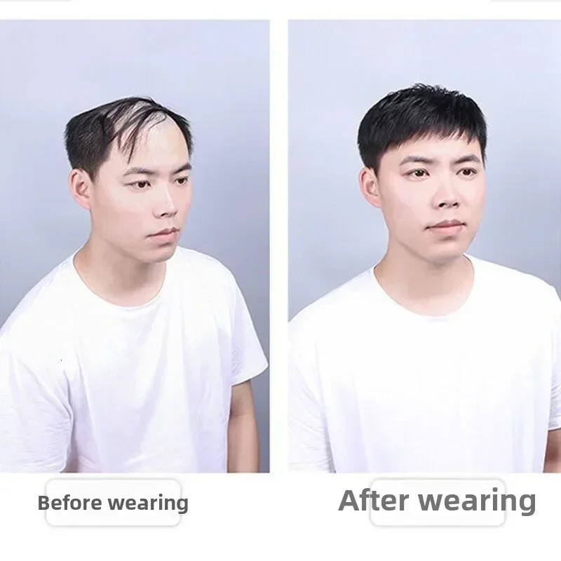 Toupee Mens Capillary Prosthesis Thin Skin Hair Replacement System Remy Hair 16*18 Natural Human Hair Forehead Hairline 250224