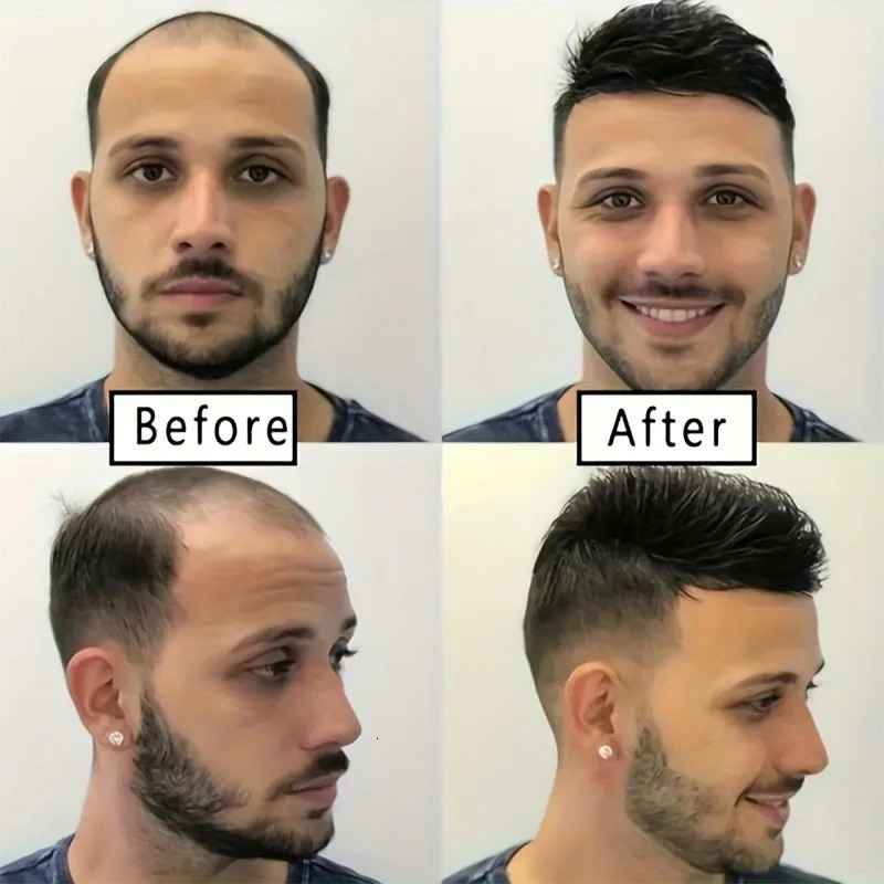 Alimice Men Hair Tropper Hair Pieces Short Wig Black Short Wig Breathable Invisible Daily Straight Bangs Clip On Hair 250224