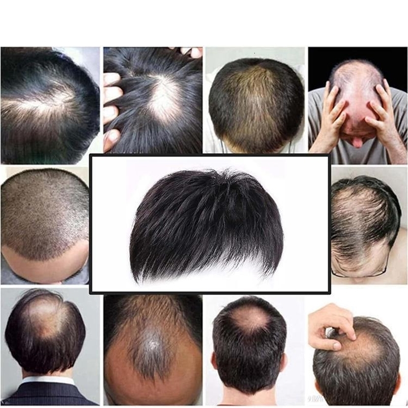 100% Natural Human Hair Toupee with Clips on Short Hair Replacement System Prosthetic Mens Wig Male Pieces For Men Baldnes 250224