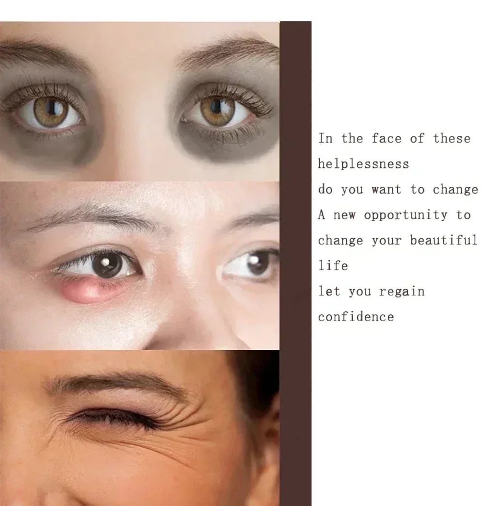 Eye Cream For Anti Aging Dark Circles Bags Puffiness Great Under Eye Skin Face Eye Lift Treatment Care 250222