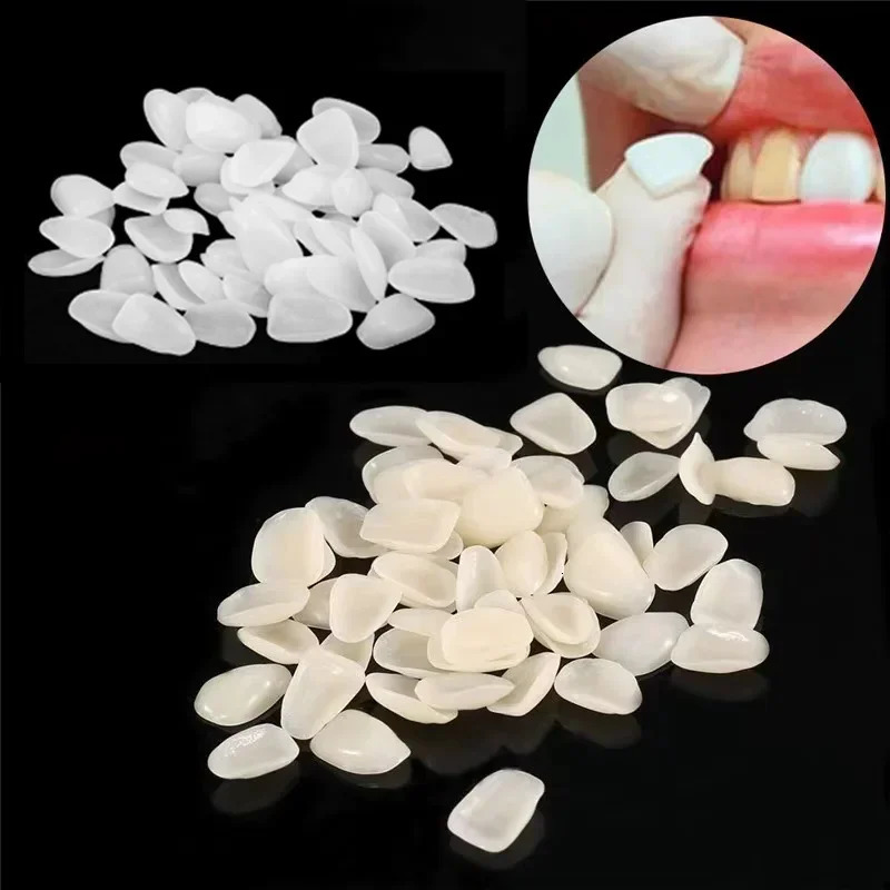 500 PCS Teeth Veneers Resin Temporary Crown Ultra Thin Repair Whitening Sets Dentist False Tooth Oral Care Cleaning Materials 250226