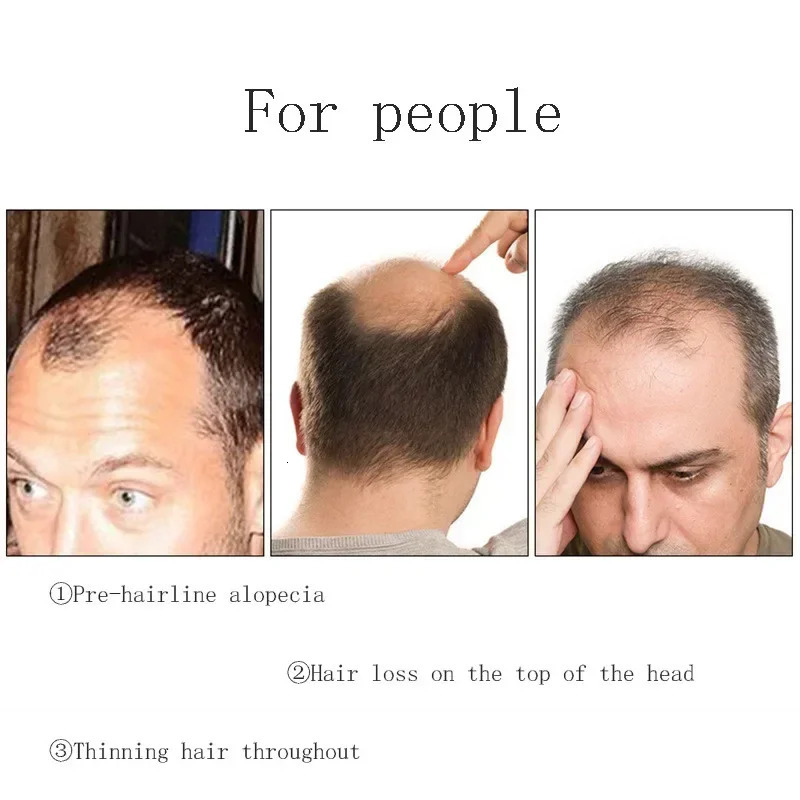 Mens Swiss Lace Hair Replacement System Hair Unit Base 16*18 Toupee 100% Artificial Hair Prostheses for Men 250227