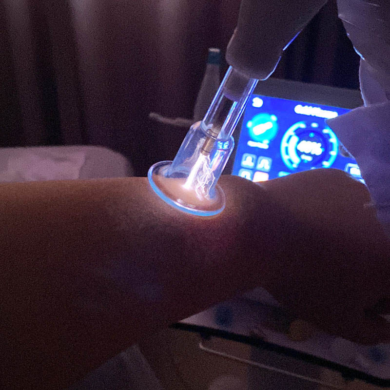 Custom Logo 6 IN 1 Hot and Cold Spark Plasma Beauty Machine Freckle Removal Facial Anti-Aging Face Lifting Care Rejunevation Fusion Plasma Treatment D