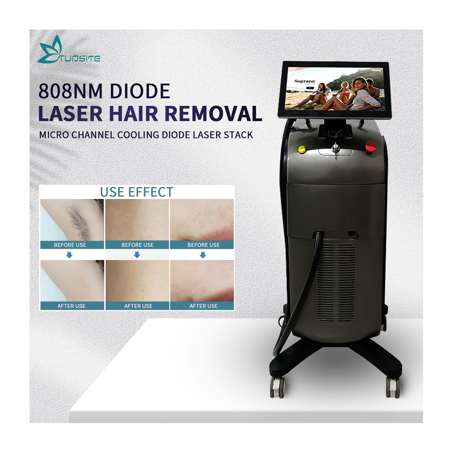 CE FDA Certified 3000W Diode Laser Hair Removal Machine/4-Wavelength 755 808 940 1064nm Ice Cooling