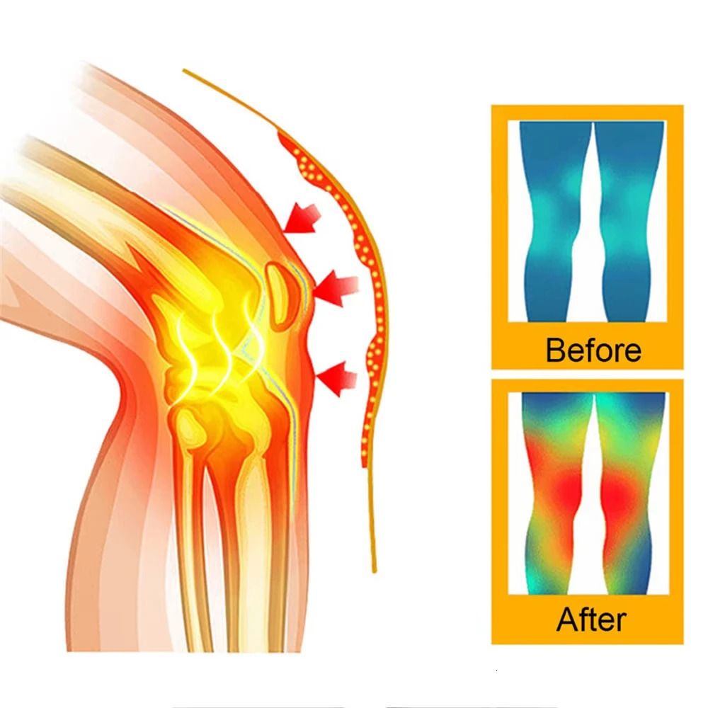 2PCS Self Heating Knee Braces Sleeve Tourmaline Support Far Infrared Keep Warm Pads 250530