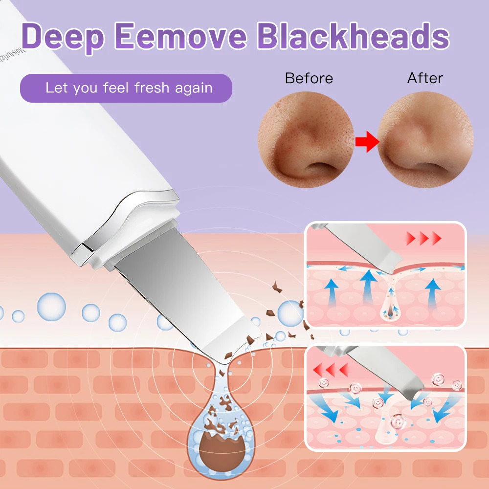 Ultrasonic Peeling Machine Skin Care Blackhead r Device Face Cleaning Pore Cleanser Massager Skin Scrubber 250523