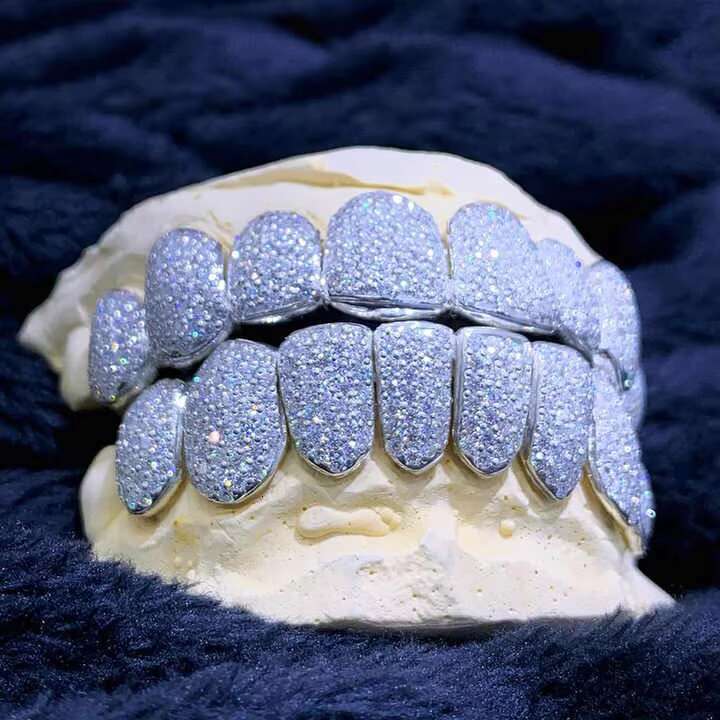 Custom Iced Out HipHop Blue Moissanite Grillz for Men and Women - VVS Diamond Dental Jewelry Bling Teeth Grills 925 Silver