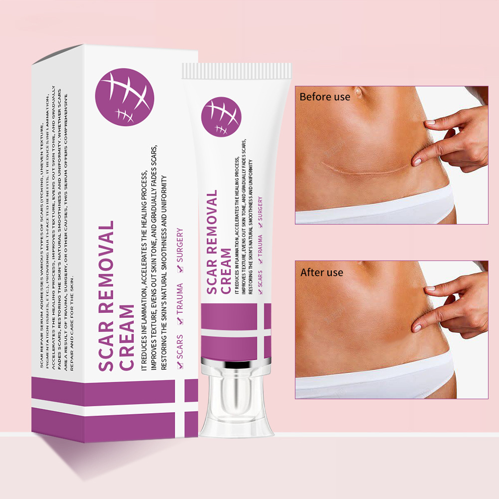Professional Grade Fade Out Treatment Cream: Intensive Care For Scars & Discoloration