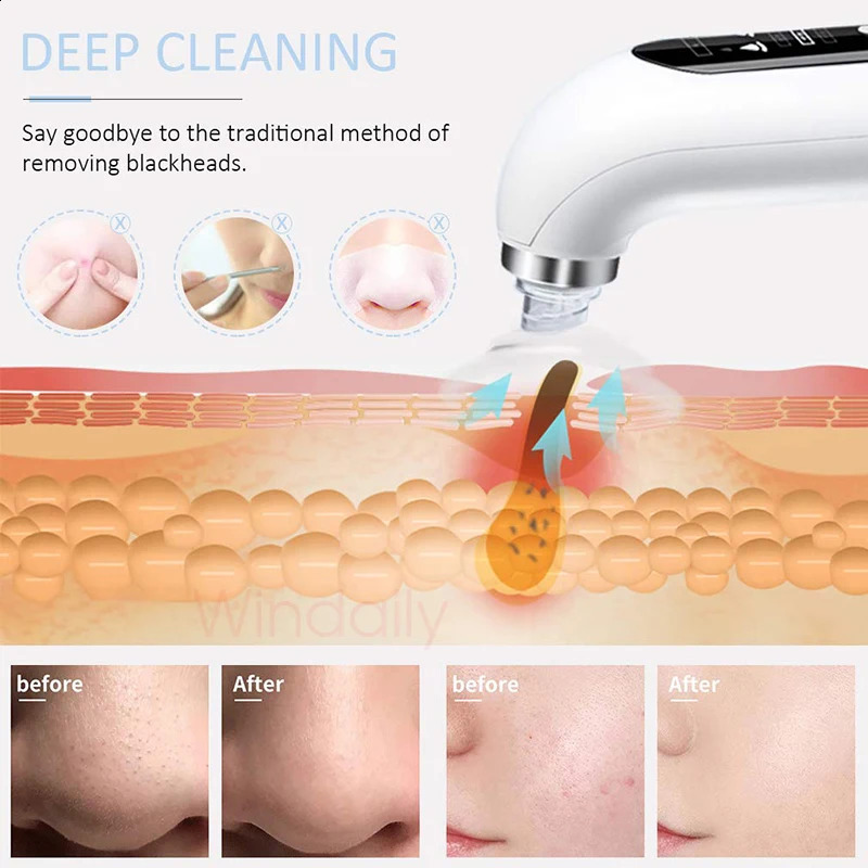 Blackhead r Pore Vacuum Cleaner Electric Micro Small Bubble Cleasing Machine USB Rechargeable Beauty Device 250523