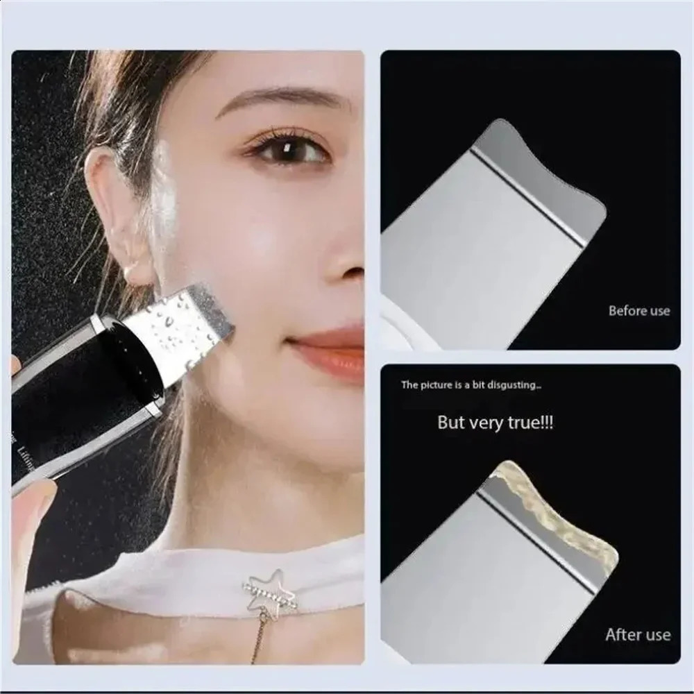 Blackhead r Blackhead Cleaning Pore Beauty Device Dead Skin Scalper Pore Cleanser Beauty Equipment 250523