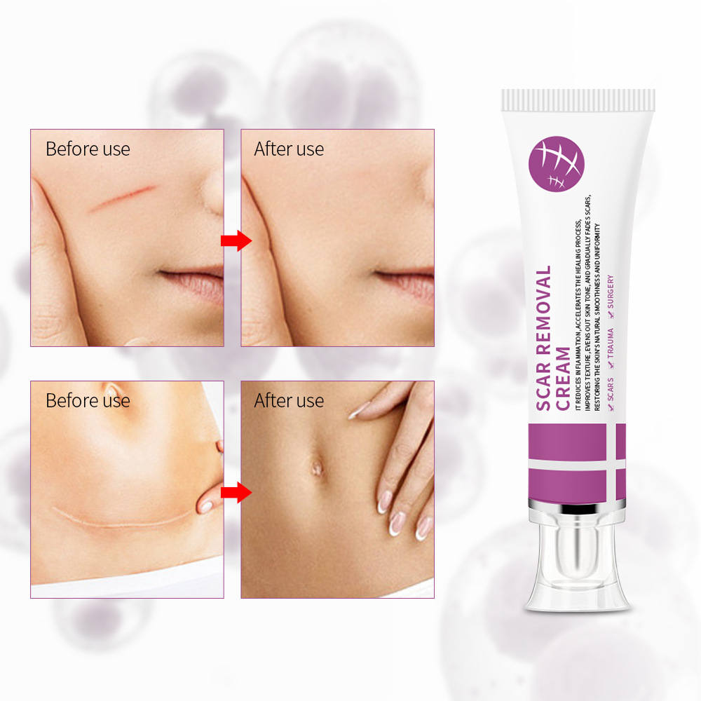 Professional Grade Fade Out Treatment Cream: Intensive Care For Scars & Discoloration